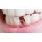 bestdentist [licensed for non-commercial use only] / Why Gum Specialist Dentists are Needed