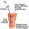           Karishma Vein Clinic Pune   &#8211;  Varicose Veins Treatment         