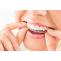 Trends in Invisalign Invisible Braces