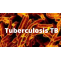 Tuberculosis TB Meaning, Symptoms, Causes, Test And Vaccine