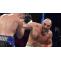 Tyson Fury defeats Otto Wallin in 12 rounds overcomes bloodied eye