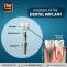 What is the structure of a dental implants?
