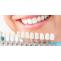 What Patients Need to Know about Dental Implants